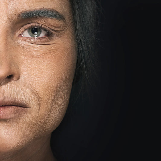 Mujer mayor con piel arrugada